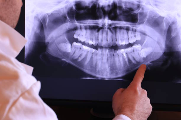 Best Root Canal Emergency Dentist  in Sturgeon, PA